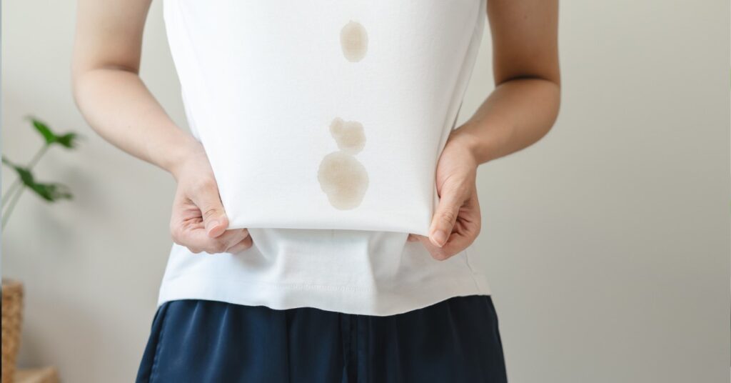 nő fehér foltos felsőben áll