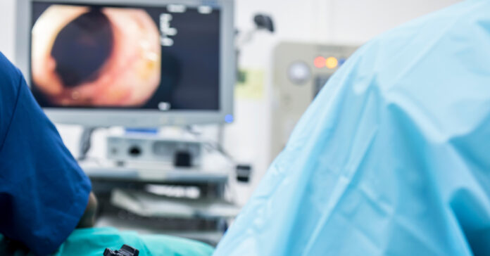 vastagbélszűrés igénylés