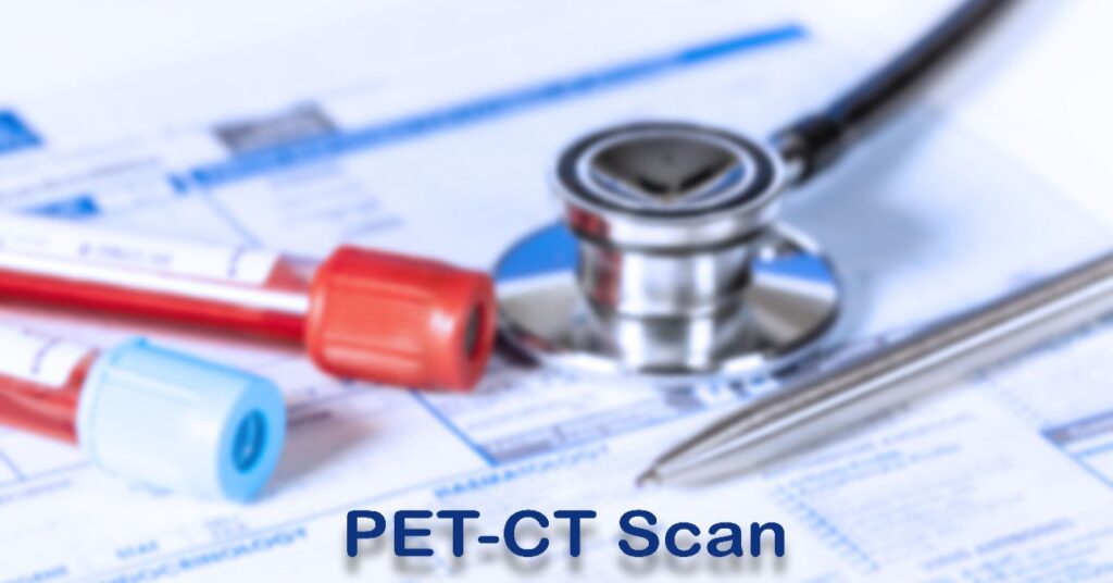 PET-CT.