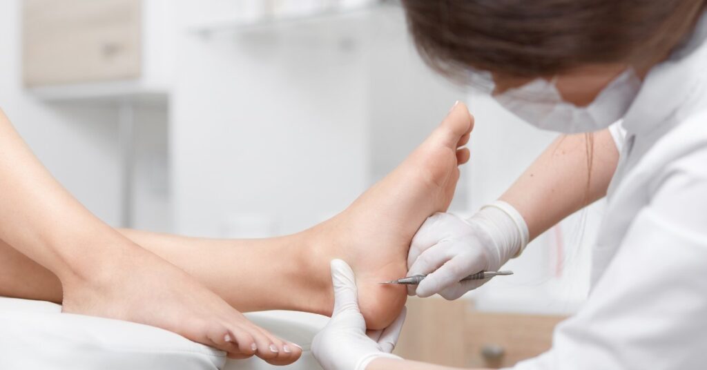 pedikűrös tyúkszemet kezel