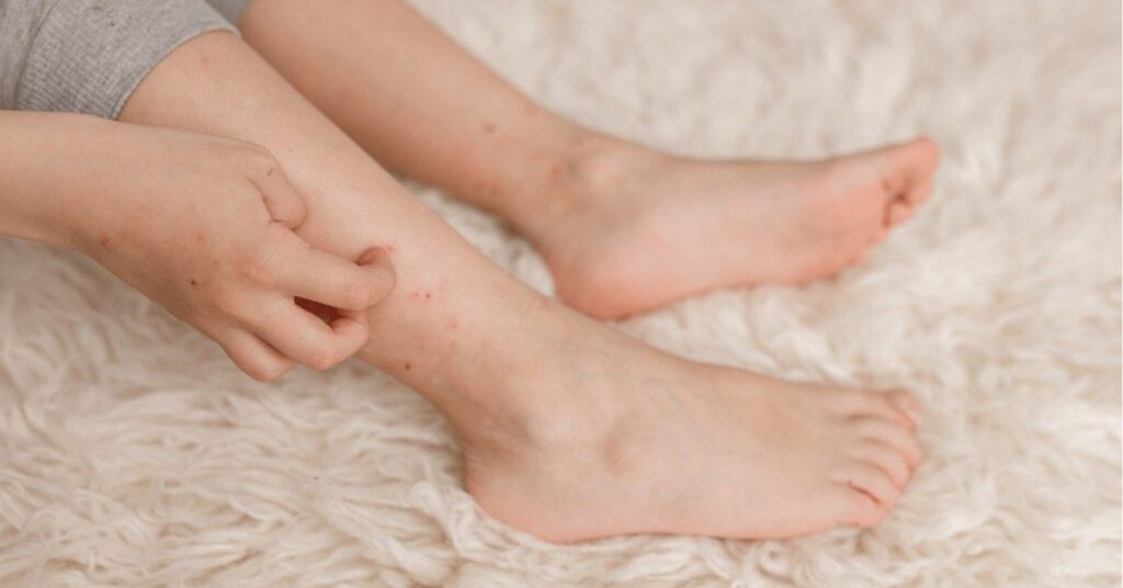 ágyi poloska ürülék