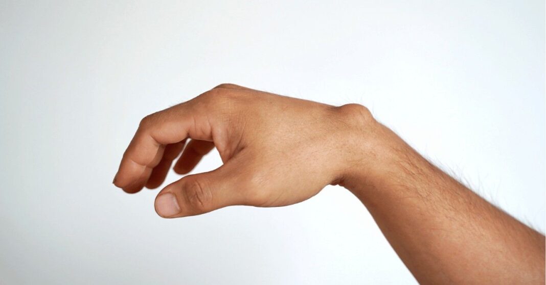 ganglion kezelése házilag